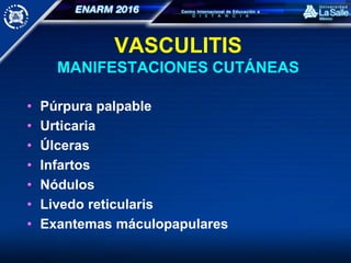 VASCULITIS
MANIFESTACIONES CUTÁNEAS
• Púrpura palpable
• Urticaria
• Úlceras
• Infartos
• Nódulos
• Livedo reticularis
• Exantemas máculopapulares
 