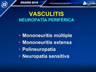 VASCULITIS
NEUROPATÍA PERIFÉRICA
• Mononeuritis múltiple
• Mononeuritis extensa
• Polineuropatía
• Neuropatía sensitiva
 