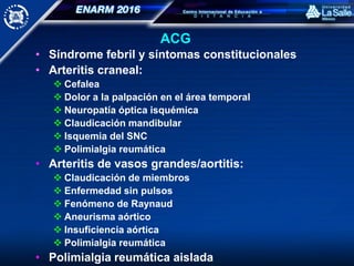 ACG
• Síndrome febril y síntomas constitucionales
• Arteritis craneal:
 Cefalea
 Dolor a la palpación en el área temporal
 Neuropatía óptica isquémica
 Claudicación mandibular
 Isquemia del SNC
 Polimialgia reumática
• Arteritis de vasos grandes/aortitis:
 Claudicación de miembros
 Enfermedad sin pulsos
 Fenómeno de Raynaud
 Aneurisma aórtico
 Insuficiencia aórtica
 Polimialgia reumática
• Polimialgia reumática aislada
 
