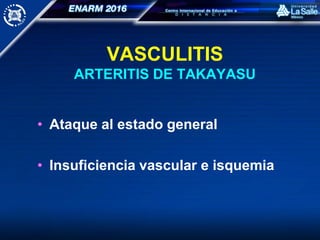 VASCULITIS
ARTERITIS DE TAKAYASU
• Ataque al estado general
• Insuficiencia vascular e isquemia
 
