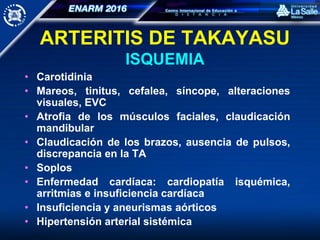 ARTERITIS DE TAKAYASU
ISQUEMIA
• Carotidinia
• Mareos, tinitus, cefalea, síncope, alteraciones
visuales, EVC
• Atrofia de los músculos faciales, claudicación
mandibular
• Claudicación de los brazos, ausencia de pulsos,
discrepancia en la TA
• Soplos
• Enfermedad cardíaca: cardiopatía isquémica,
arritmias e insuficiencia cardíaca
• Insuficiencia y aneurismas aórticos
• Hipertensión arterial sistémica
 