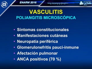 VASCULITIS
POLIANGITIS MICROSCÓPICA
• Síntomas constitucionales
• Manifestaciones cutáneas
• Neuropatía periférica
• Glomerulonefritis pauci-inmune
• Afectación pulmonar
• ANCA positivos (70 %)
 