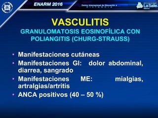 VASCULITIS
GRANULOMATOSIS EOSINOFÍLICA CON
POLIANGITIS (CHURG-STRAUSS)
• Manifestaciones cutáneas
• Manifestaciones GI: dolor abdominal,
diarrea, sangrado
• Manifestaciones ME: mialgias,
artralgias/artritis
• ANCA positivos (40 – 50 %)
 