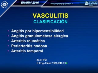 VASCULITIS
CLASIFICACIÓN
• Angitis por hipersensibilidad
• Angitis granulomatosa alérgica
• Arteritis reumática
• Periarteritis nodosa
• Arteritis temporal
Zeek PM
N Eng J Med 1953;248:764
 
