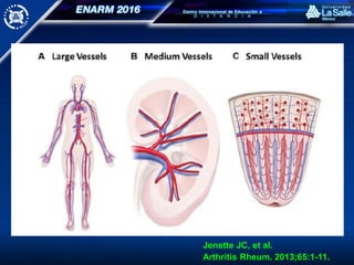 Jenette JC, et al.
Arthritis Rheum. 2013;65:1-11.
 