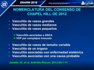 NOMENCLATURA DEL CONSENSO DE
CHAPEL HILL DE 2012
• Vasculitis de vasos grandes
• Vasculitis de vasos medianos
• Vasculitis de vasos pequeños
 Vasculitis asociadas a ANCA
 VVP por complejos inmunes
• Vasculitis de vasos de tamaño variable
• Vasculitis de un órgano
• Vasculitis asociadas con enfermedad sistémica
• Vasculitis asociadas con una causa probable
Jenette JC, et al. Arthritis Rheum. 2013;65:1-11.
 