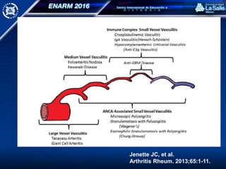 Jenette JC, et al.
Arthritis Rheum. 2013;65:1-11.
 