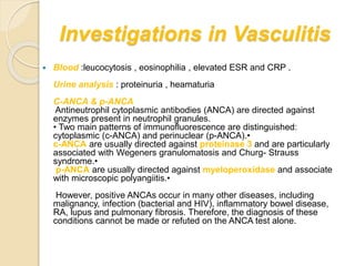 Vasculitis | PPTX