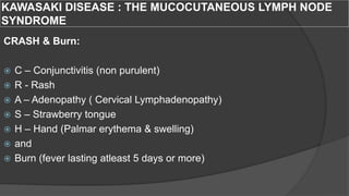 KAWASAKI DISEASE : THE MUCOCUTANEOUS LYMPH NODE
SYNDROME
CRASH & Burn:
 C – Conjunctivitis (non purulent)
 R - Rash
 A – Adenopathy ( Cervical Lymphadenopathy)
 S – Strawberry tongue
 H – Hand (Palmar erythema & swelling)
 and
 Burn (fever lasting atleast 5 days or more)
 