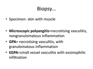 Biopsy…
• Specimen- skin with muscle
• Microscopic polyangitis=necrotising vasculitis,
nongranulomatous inflammation
• GPA= necrotising vasculitis, with
granulomatous inflammation
• EGPA=small vessel vasculitis with eosinophilic
infiltration
 