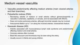 Medium vessel vasculitis
• Vasculitis predominantly affecting medium arteries (main visceral arteries
and their branches).
• Polyarteritis nodosa (PAN)
– Necrotizing arteritis of medium or small arteries without glomerulonephritis or
vasculitis in arterioles, capillaries, or venules, and not associated with ANCAs.
– Does not involve pulmonary arteries, although bronchial vessels may be involved.
– Aneurysmal dilation up to 1 cm along the involved arteries: characteristic feature.
• Kawasaki disease (KD)
– Arteritis associated with mucocutaneous lymph node syndrome and predominantly
affecting medium and small arteries.
– Coronary arteries often involved.
– Bead like aneurysm and thrombosis may be seen along the artery.
– Usually occurs in infants and young children.
 