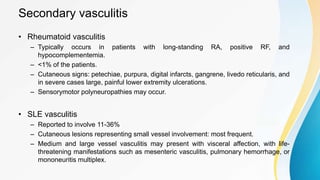 Secondary vasculitis
• Rheumatoid vasculitis
– Typically occurs in patients with long-standing RA, positive RF, and
hypocomplementemia.
– <1% of the patients.
– Cutaneous signs: petechiae, purpura, digital infarcts, gangrene, livedo reticularis, and
in severe cases large, painful lower extremity ulcerations.
– Sensorymotor polyneuropathies may occur.
• SLE vasculitis
– Reported to involve 11-36%
– Cutaneous lesions representing small vessel involvement: most frequent.
– Medium and large vessel vasculitis may present with visceral affection, with life-
threatening manifestations such as mesenteric vasculitis, pulmonary hemorrhage, or
mononeuritis multiplex.
 
