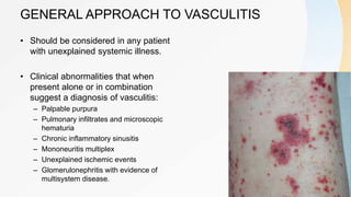 GENERAL APPROACH TO VASCULITIS
• Should be considered in any patient
with unexplained systemic illness.
• Clinical abnormalities that when
present alone or in combination
suggest a diagnosis of vasculitis:
– Palpable purpura
– Pulmonary infiltrates and microscopic
hematuria
– Chronic inflammatory sinusitis
– Mononeuritis multiplex
– Unexplained ischemic events
– Glomerulonephritis with evidence of
multisystem disease.
 