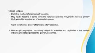 • Tissue Biopsy
– Definitive method of diagnosis of vasculitis.
– May not be feasible in some forms like Takayasu arteritis, Polyarteritis nodosa, primary
CNS vasculitis: arteriogram of suspected organs.
– Giant cell arteritis: Biopsy of temporal artery essential.
– Microscopic polyangiitis: necrotizing angiitis in arterioles and capillaries in the kidneys
indicating necrotizing crescentic glomerulonephritis.
 