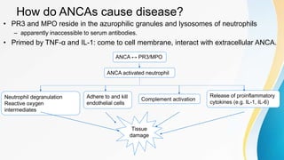 How do ANCAs cause disease?
• PR3 and MPO reside in the azurophilic granules and lysosomes of neutrophils
– apparently inaccessible to serum antibodies.
• Primed by TNF-α and IL-1: come to cell membrane, interact with extracellular ANCA.
ANCA ↔ PR3/MPO
ANCA activated neutrophil
Neutrophil degranulation
Reactive oxygen
intermediates
Tissue
damage
Adhere to and kill
endothelial cells
Release of proinflammatory
cytokines (e.g. IL-1, IL-6)
Complement activation
 