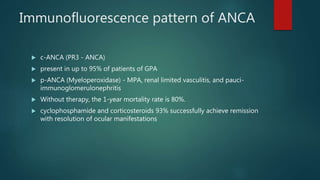 Immunofluorescence pattern of ANCA
 c-ANCA (PR3 - ANCA)
 present in up to 95% of patients of GPA
 p-ANCA (Myeloperoxidase) - MPA, renal limited vasculitis, and pauci-
immunoglomerulonephritis
 Without therapy, the 1-year mortality rate is 80%.
 cyclophosphamide and corticosteroids 93% successfully achieve remission
with resolution of ocular manifestations
 