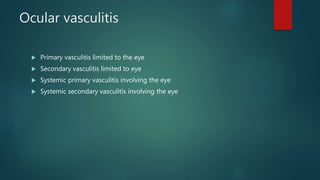 Ocular vasculitis
 Primary vasculitis limited to the eye
 Secondary vasculitis limited to eye
 Systemic primary vasculitis involving the eye
 Systemic secondary vasculitis involving the eye
 