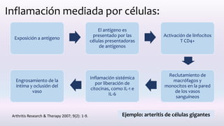 Inflamación mediada por células:
Exposición a antígeno
El antígeno es
presentado por las
células presentadoras
de antígenos
Activación de linfocitos
T CD4+
Reclutamiento de
macrófagos y
monocitos en la pared
de los vasos
sanguíneos
Inflamación sistémica
por liberación de
citocinas, como IL-1 e
IL-6
Engrosamiento de la
íntima y oclusión del
vaso
Ejemplo: arteritis de células gigantesArthritis Research & Therapy 2007; 9(2): 1-9.
 