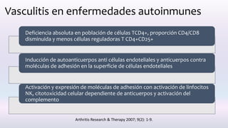 Vasculitis en enfermedades autoinmunes
Deficiencia absoluta en población de células TCD4+, proporción CD4/CD8
disminuida y menos células reguladoras T CD4+CD25+
Inducción de autoanticuerpos anti células endoteliales y anticuerpos contra
moléculas de adhesión en la superficie de células endoteliales
Activación y expresión de moléculas de adhesión con activación de linfocitos
NK, citotoxicidad celular dependiente de anticuerpos y activación del
complemento
Arthritis Research & Therapy 2007; 9(2): 1-9.
 