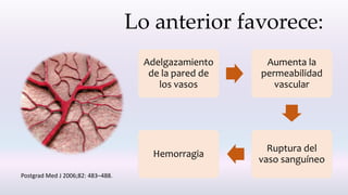 Lo anterior favorece:
Adelgazamiento
de la pared de
los vasos
Aumenta la
permeabilidad
vascular
Ruptura del
vaso sanguíneo
Hemorragia
Postgrad Med J 2006;82: 483–488.
 
