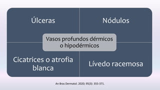 Úlceras Nódulos
Cicatrices o atrofia
blanca
Lívedo racemosa
Vasos profundos dérmicos
o hipodérmicos
An Bras Dermatol. 2020; 95(3): 355-371.
 