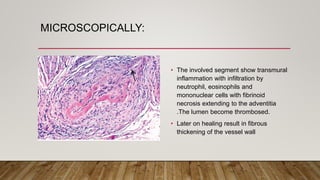 MICROSCOPICALLY:
• The involved segment show transmural
inflammation with infiltration by
neutrophil, eosinophils and
mononuclear cells with fibrinoid
necrosis extending to the adventitia
.The lumen become thrombosed.
• Later on healing result in fibrous
thickening of the vessel wall
 