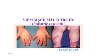 VIÊM MẠCH MÁU Ở TRẺ EM
(Pediatric vasculitis )
BS.NHỮ THU HÀ
12/5/2021 1
 