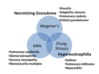 Wegener’s
Churg-
Strauss
MPA
Necrotizing Granuloma
Hypereosinophilia
•Sinusitis
•Subglottic stenosis
•Pulmonary nodules
•Orbital pseudotumor
•Asthma
•Pulmonary infiltrates
•Myocarditis
•Pulmonary capillaritis
•Glomerulonephritis
•Sensory neuropathy
•Mononeuritis multiplex
 