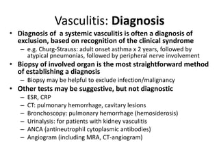 • Diagnosis of a systemic vasculitis is often a diagnosis of
exclusion, based on recognition of the clinical syndrome
– e.g. Churg-Strauss: adult onset asthma x 2 years, followed by
atypical pneumonias, followed by peripheral nerve involvement
• Biopsy of involved organ is the most straightforward method
of establishing a diagnosis
– Biopsy may be helpful to exclude infection/malignancy
• Other tests may be suggestive, but not diagnostic
– ESR, CRP
– CT: pulmonary hemorrhage, cavitary lesions
– Bronchoscopy: pulmonary hemorrhage (hemosiderosis)
– Urinalysis: for patients with kidney vasculitis
– ANCA (antineutrophil cytoplasmic antibodies)
– Angiogram (including MRA, CT-angiogram)
Vasculitis: Diagnosis
 