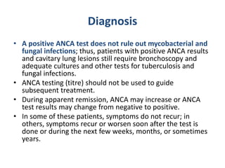 Vasculitis.pptx