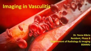 Imaging in Vasculitis
Dr. Yasna Kibria
Resident, Phase B
Department of Radiology & Imaging
BSMMU
 