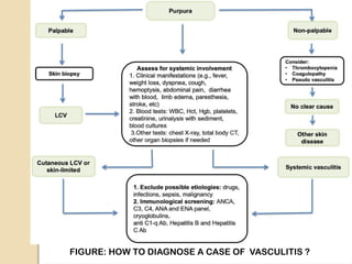 FIGURE: HOW TO DIAGNOSE A CASE OF VASCULITIS ?
 