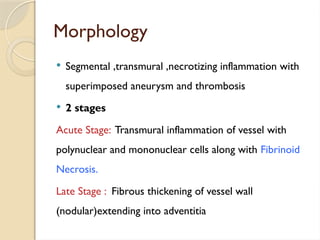 Morphology
 Segmental ,transmural ,necrotizing inflammation with
superimposed aneurysm and thrombosis
 2 stages
Acute Stage: Transmural inflammation of vessel with
polynuclear and mononuclear cells along with Fibrinoid
Necrosis.
Late Stage : Fibrous thickening of vessel wall
(nodular)extending into adventitia
 