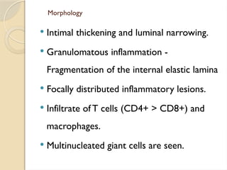 Morphology
 Intimal thickening and luminal narrowing.
 Granulomatous inflammation -
Fragmentation of the internal elastic lamina
 Focally distributed inflammatory lesions.
 Infiltrate of T cells (CD4+ > CD8+) and
macrophages.
 Multinucleated giant cells are seen.
 