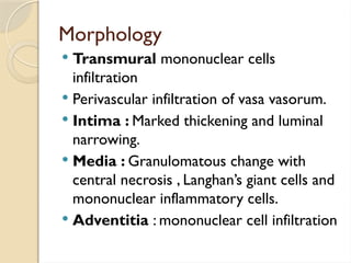 Morphology
 Transmural mononuclear cells
infiltration
 Perivascular infiltration of vasa vasorum.
 Intima : Marked thickening and luminal
narrowing.
 Media : Granulomatous change with
central necrosis , Langhan’s giant cells and
mononuclear inflammatory cells.
 Adventitia : mononuclear cell infiltration
 