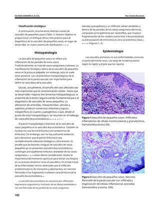 IGLESIAS GAMARRA A. & Cols. Rev.Colomb.Reumatol.
Clasificación etiológica (vénulas poscapilares) y un infiltrado celular alrededor y
dentro de las paredes de los vasos sanguíneos dérmicos,
compuesto principalmente por neutrófilos, que muestra
fragmentación de los núcleos (cariorrexis o leucocitoclasia).
La extravasación de eritrocitos es otra característica clave.61,
65, 77, 82. (Figuras 1, 2) .
A continuación, enumeramos diversas causas de
vasculitis de pequeños vasos (Tabla 1). Nuestro objetivo es
proporcionar un enfoque clínico más práctico para el
diagnóstico de la vasculitis de pequeños vasos, en lugar de
desarrollar un nuevo sistema de clasificación.51, 62, 63.
Histopatología Epidemiología
Las vasculitis primarias no son enfermedades comunes
ni particularmente raras. Las tasas de incidencia varían
según la región y el país que las reporta.
La vasculitis de pequeños vasos se refiere a la
inflamación de las paredes de estos vasos.
Tradicionalmente, se trata de vasos sanguíneos cutáneos. La
manifestación fenotípica clásica de la vasculitis de pequeños
vasos es la púrpura palpable; sin embargo, esta no suele
estar presente. Las características histopatológicas de la
inflamación de la pared vascular son importantes para
definir la naturaleza de la vasculitis.
Quizás, actualmente, el tamaño del vaso afectado sea
más importante que la caracterización celular. Hasta que
se desarrollen mejores herramientas histopatológicas, la
anatomía de la lesión seguirá siendo fundamental para el
diagnóstico de vasculitis de vasos pequeños. La
afectación de arteriolas, metaarteriolas, vénulas y
capilares produce numerosos síntomas y signos,
inespecíficos en cuanto a patogénesis o que, desde el
punto de vista histopatológico, se resumen en el hallazgo
de «vasculitis leucocitoclástica».60, 67, 68, 74, 76, 77.
Figura 1.Vasculitis de pequeños vasos. Infiltrados
inflamatorios de células mononucleares y granulocíticas.
Hematoxilina-eosina 20X.
El patrón histopatológico distintivo de la vasculitis de
vasos pequeños es la vasculitis leucocitoclástica. También se
ha descrito una forma linfocítica (con predominio de
linfocitos). Sin embargo, aún no hay suficiente evidencia
para demostrar que el patrón linfocitario sea
verdaderamente relevante etiológica o clínicamente. Es
posible que las lesiones antiguas de vasculitis de vasos
pequeños ya no presenten vasculitis leucocitoclástica y
contengan principalmente linfocitos alrededor de los vasos
sanguíneos.67, 68, 78-80Esta última consideración recalca la
importancia del momento oportuno para tomar una biopsia
en un proceso dinámico como el vasculítico. En la fase inicial
de la enfermedad, hemos observado que el infiltrado
predominante es de monocitos y plasmocitos, sin necrosis
fibrinoide ni los fragmentos nucleares característicos de la
vasculitis leucocitoclástica.81. Figura 2.Vasculitis de pequeños vasos. Necrosis
fibrinoide de la pared vascular con infiltrado y
organización de células inflamatorias asociadas
(hematoxilina y eosina, 20X).
La vasculitis leucocitoclástica se caracteriza por inflamación
segmentaria angiocéntrica, hinchazón de las células endoteliales y
necrosis fibrinoide de las paredes de los vasos sanguíneos.
192
 
