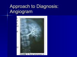 Approach to Diagnosis: Angiogram 