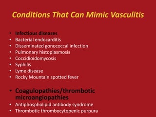 Conditions That Can Mimic Vasculitis

•   Infectious diseases
•   Bacterial endocarditis
•   Disseminated gonococcal infection
•   Pulmonary histoplasmosis
•   Coccidioidomycosis
•   Syphilis
•   Lyme disease
•   Rocky Mountain spotted fever

• Coagulopathies/thrombotic
  microangiopathies
• Antiphospholipid antibody syndrome
• Thrombotic thrombocytopenic purpura
 