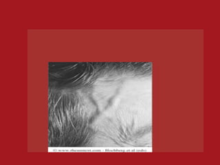 meidicine.Vasculitis 1.(dr.kawa)