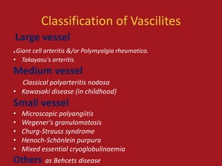 Classification of Vascilites
Large vessel
.Giant cell arteritis &/or Polymyalgia rheumatica.
• Takayasu's arteritis
Medium vessel
  Classical polyarteritis nodosa
• Kawasaki disease (in childhood)
Small vessel
•   Microscopic polyangiitis
•   Wegener's granulomatosis
•   Churg-Strauss syndrome
•   Henoch-Schönlein purpura
•   Mixed essential cryoglobulinaemia
Others     as Behcets disease.
 
