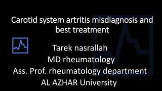 Carotid system artritis misdiagnosis and
best treatment
Tarek nasrallah
MD rheumatology
Ass. Prof. rheumatology department
AL AZHAR University
 