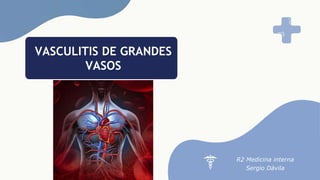 VASCULITIS DE GRANDES
VASOS
R2 Medicina interna
Sergio Dávila
 