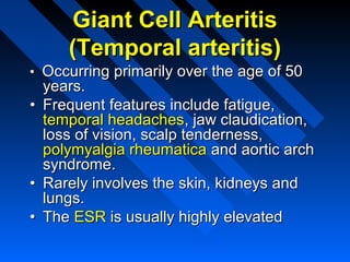 Giant Cell Arteritis
(Temporal arteritis)
• Occurring primarily over the age of 50

years.
• Frequent features include fatigue,
temporal headaches, jaw claudication,
loss of vision, scalp tenderness,
polymyalgia rheumatica and aortic arch
syndrome.
• Rarely involves the skin, kidneys and
lungs.
• The ESR is usually highly elevated

 