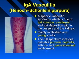 IgA Vasculitis
(Henoch–Schönlein purpura)





A specific vasculitic
syndrome which is due to
IgA immune complexes
and IgA deposition within
the vessels and the kidney.
mainly in children and
young adults
The full spectrum includes
palpable purpura, nephritis,
arthritis and gastrointestinal
involvement.

 