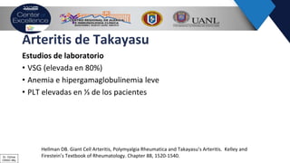 Arteritis de Takayasu
Estudios de laboratorio
• VSG (elevada en 80%)
• Anemia e hipergamaglobulinemia leve
• PLT elevadas en ⅓ de los pacientes
Hellman DB. Giant Cell Arteritis, Polymyalgia Rheumatica and Takayasu’s Arteritis. Kelley and
Firestein’s Textbook of Rheumatology. Chapter 88, 1520-1540.Dr. Ochoa
CRAIC Mty
 
