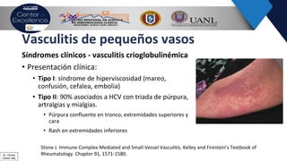 Vasculitis de pequeños vasos
Síndromes clínicos - vasculitis crioglobulinémica
• Presentación clínica:
• Tipo I: síndrome de hiperviscosidad (mareo,
confusión, cefalea, embolia)
• Tipo II: 90% asociados a HCV con triada de púrpura,
artralgias y mialgias.
• Púrpura confluente en tronco, extremidades superiores y
cara
• Rash en extremidades inferiores
Stone J. Immune Complex-Mediated and Small-Vessel Vasculitis. Kelley and Firestein’s Textbook of
Rheumatology. Chapter 91, 1571-1580.Dr. Ochoa
CRAIC Mty
 
