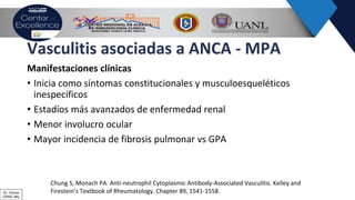 Vasculitis asociadas a ANCA - MPA
Manifestaciones clínicas
• Inicia como síntomas constitucionales y musculoesqueléticos
inespecíficos
• Estadíos más avanzados de enfermedad renal
• Menor involucro ocular
• Mayor incidencia de fibrosis pulmonar vs GPA
Chung S, Monach PA. Anti-neutrophil Cytoplasmic Antibody-Associated Vasculitis. Kelley and
Firestein’s Textbook of Rheumatology. Chapter 89, 1541-1558.Dr. Ochoa
CRAIC Mty
 