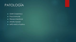 PATOLOGÍA
 GMN Creséntica
 Pauci-inmune
 Fibrosis intersticial
 Atrofia tubular
 MPO-ANCA Positivo
 