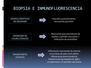BIOPSIA E INMUNOFLUORESCENCIA

GRANULOMATOSIS        Vasculitis granulomatosa
  DE WEGENER            necrosante (pulmón)




                     Reacciones granulomatosas de
 SINDROME DE         tejidos y paredes vasculares +
CHURG STRAUSS          infiltración de eosinófilos




                  Inflamación necrosante de arterias
 PANARTERITIS       musculares de peq-med calibre:
   NUDOSA             dilataciones aneurismáticas
                   Presencia de Ag hepatitis B, IgM y
                 complemento en paredes vasculares
 