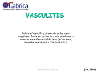 Indica inflamación y alteración de los vasos
sanguíneos. Puede ser primaria, o más comúnmente
secundaria a enfermedad de base (infecciones,
neoplasia, reacciones a fármacos, etc.).
(Lie, 1992).
 
